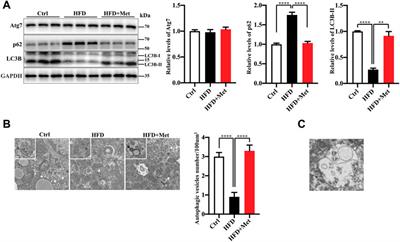 Metformin Alleviates Hepatic Steatosis and Insulin Resistance in a Mouse Model of High-Fat Diet-Induced Nonalcoholic Fatty Liver Disease by Promoting Transcription Factor EB-Dependent Autophagy